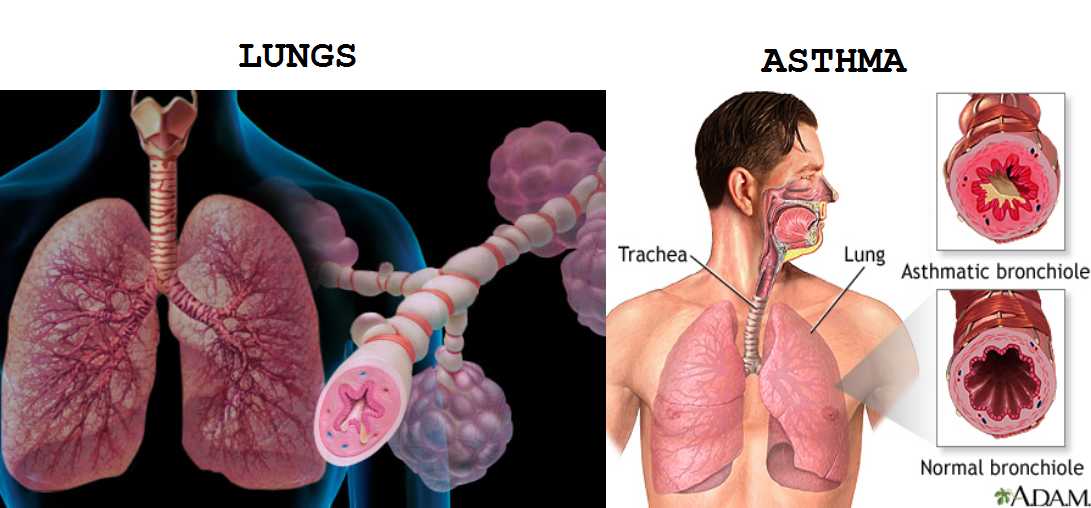 Asthma suffers last fan pic